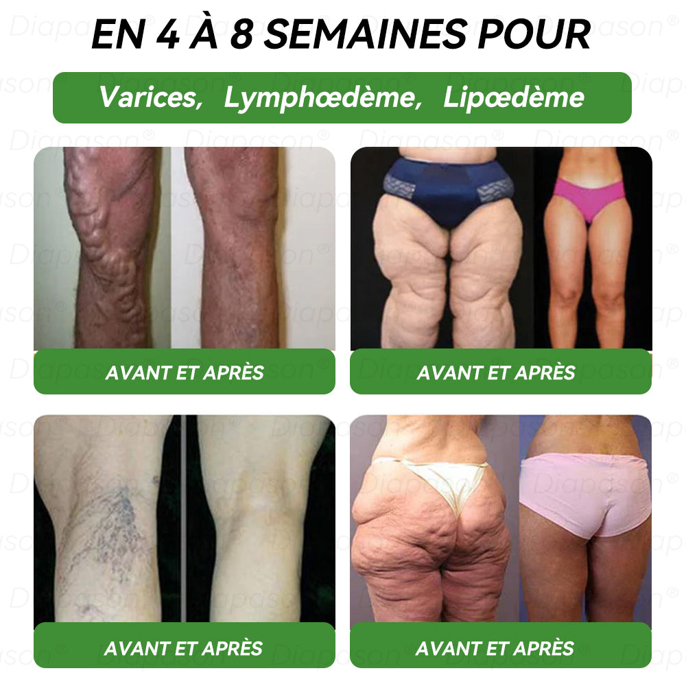 𝐵𝑜𝑢𝑡𝑖𝑞𝑢𝑒 𝑂𝑓𝑓𝑖𝑐𝑖𝑒𝑙𝑙𝑒 |𝐃𝐢𝐚𝐩𝐚𝐬𝐨𝐧® 👨⚕️𝑮𝑳P-1 𝑺𝒆𝒑𝒕 𝒆𝒏 𝑼𝒏 𝑺𝒐𝒍𝒖𝒕𝒊𝒐𝒏 𝒅𝒆 𝑺𝒂𝒏𝒕𝒆́ 𝑮𝒍𝒐𝒃𝒂𝒍𝒆 𝑬𝒏 𝑳𝒊𝒒𝒖𝒊𝒅𝒆 𝑶𝒓𝒂𝒍✅Pour l'obésité, la santé cardiovasculaire, le diabète, l'apnée du sommeil, les problèmes articulaires et bien plus