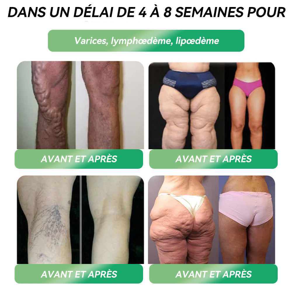 𝑩𝒐𝒖𝒕𝒊𝒒𝒖𝒆 𝑶𝒇𝒇𝒊𝒄𝒊𝒆𝒍𝒍𝒆| 𝐋𝐄𝑹𝑪𝐄𝐀®👨‍⚕️𝑨𝒎𝒑𝒐𝒖𝒍𝒆𝒔 𝑶𝒓𝒂𝒍𝒆𝒔 𝑬́𝒒𝒖𝒊𝒍𝒊𝒃𝒓𝒆 𝑴𝒆́𝒕𝒂𝒃𝒐𝒍𝒊𝒒𝒖𝒆 𝑮𝑳P-1 Obésité, maladies cardiovasculaires, diabète, apnée du sommeil, troubles articulaires et autres affections💖